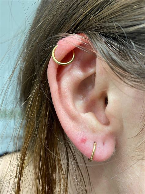 Lobe Piercing Hard Lump at Jeremy Shockley blog