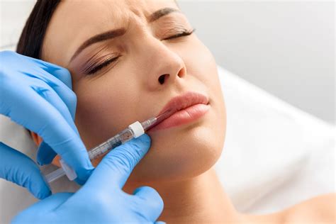 Revolutionizing Your Smile: How Lip Fillers Can Redefine M Shaped Lips