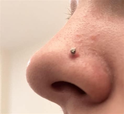 Piercing bump or keloid? : r/PiercingAdvice