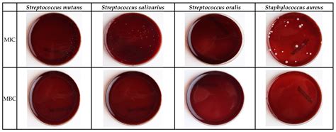 Streptococcus Salivarius