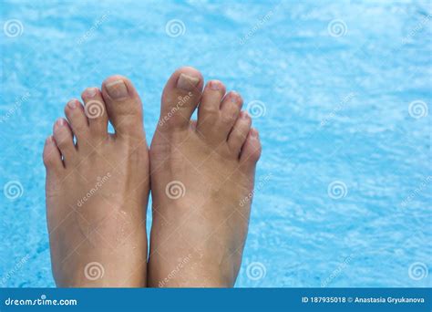 Top View of Female Legs with Fused Middle Toes on Blue Pool Background. Webbed Toes Genetic ...
