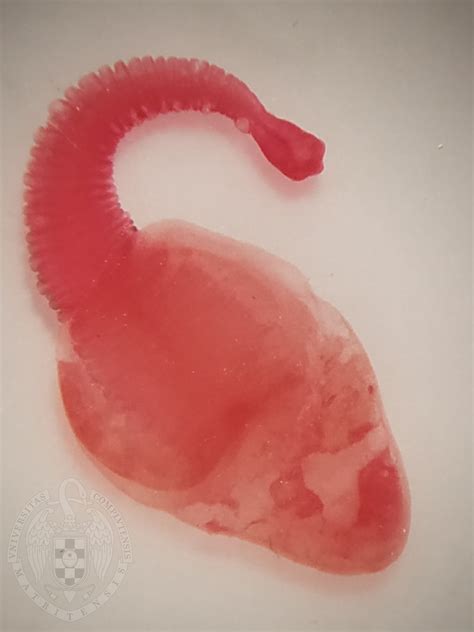 Taenia solium