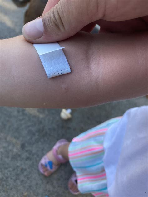 Possibly praying mantis bug bite : r/bugbites