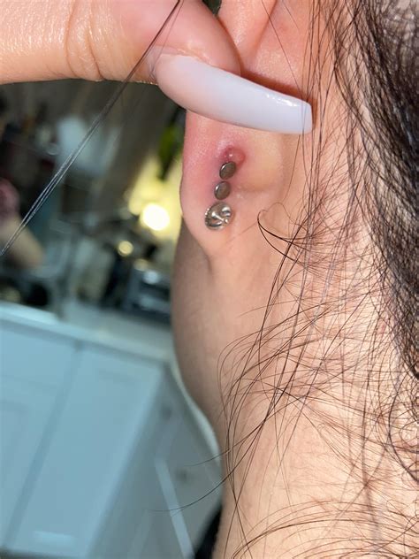 Ear Piercings Infection Bump