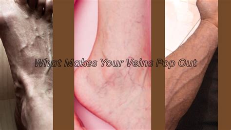 What Makes Your Veins Pop Out: Understanding Visible Veins - Elite Vascular & Wellness | New ...