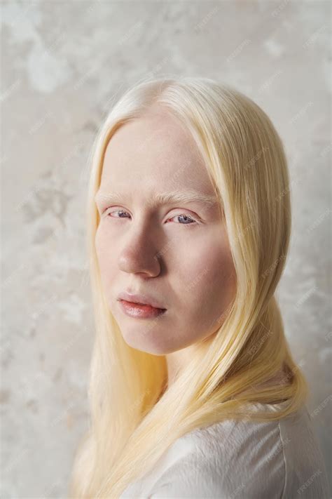 Most Beautiful Albino People