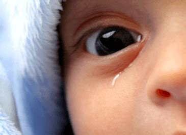 Symptoms of Epiphora: Too Much Watering of Your Baby's Eyes