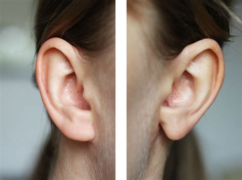 Celebrities With Attached Earlobes