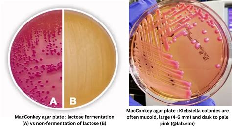 Macconkey Agar Color