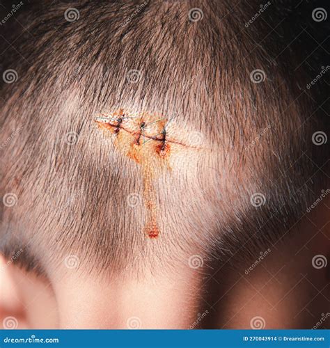 Closeup Of A Sutured Incision On A Young Dog`s Lower Abdomen A Day ...