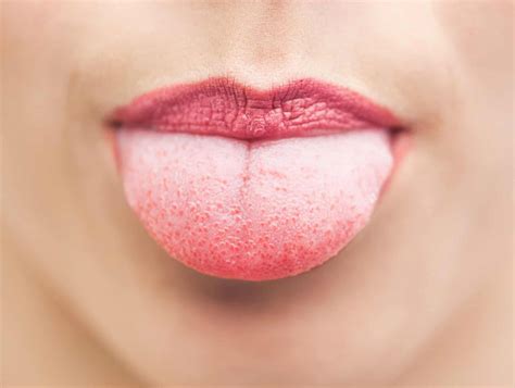 Itchy Tongue: Causes & Treatments | Longevita
