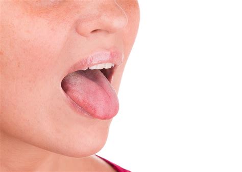Stress Bumps On Tongue