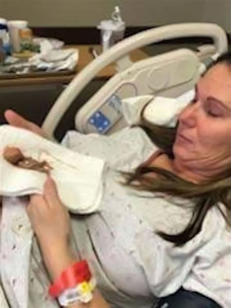 Photos of ‘Perfectly Formed’ 14-Week Miscarried Baby Are Saving Lives ...