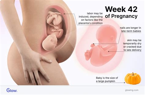 42 Weeks Pregnant: What to Do When You’re Overdue