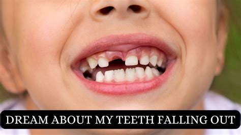 Dream About My Teeth Falling Out - What Does It Mean?