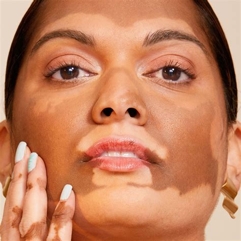 Does Toothpaste On Spots Actually Work? The Experts Weigh In | Glamour UK