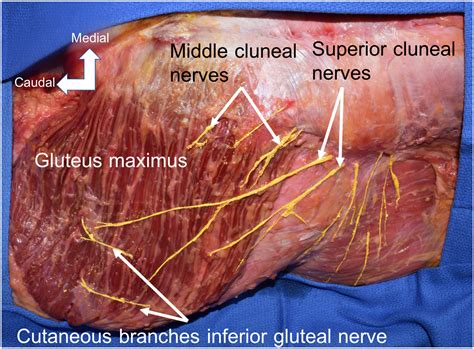 Superior Gluteal Nerve Model