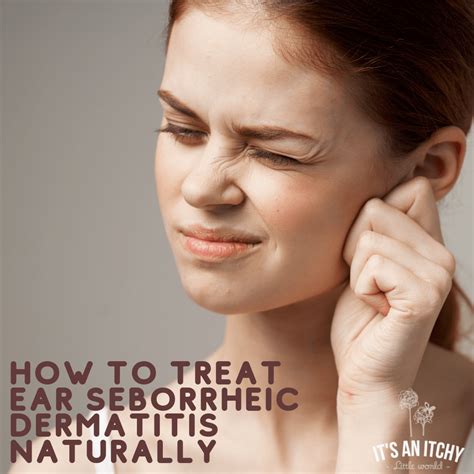 Natural Treatments for Ear Seborrheic Dermatitis | itchylittleworld.com