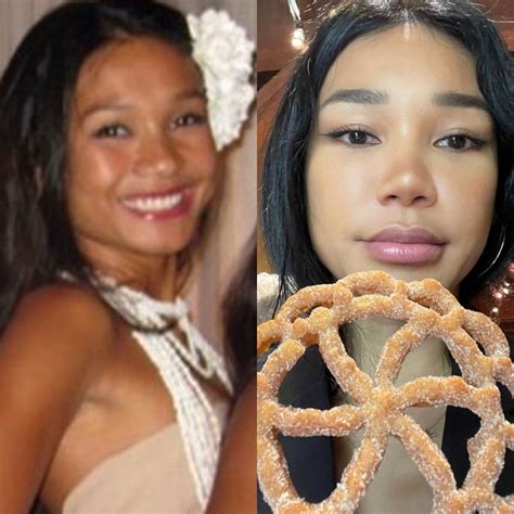 Flawless glow up of Joleen Diaz | Lip fillers, Eyelid lift, Botox