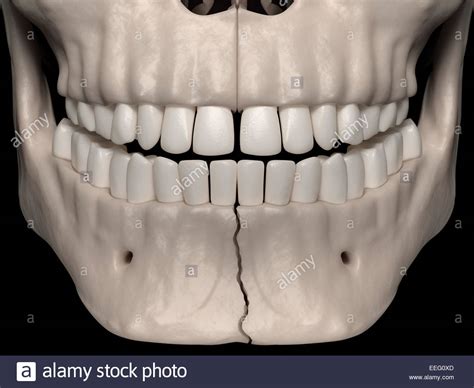 Human Jaw Bone High Resolution Stock Photography and Images - Alamy