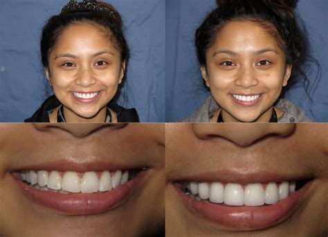Dental Professionals Of Lincoln Park at Anna Beyers blog