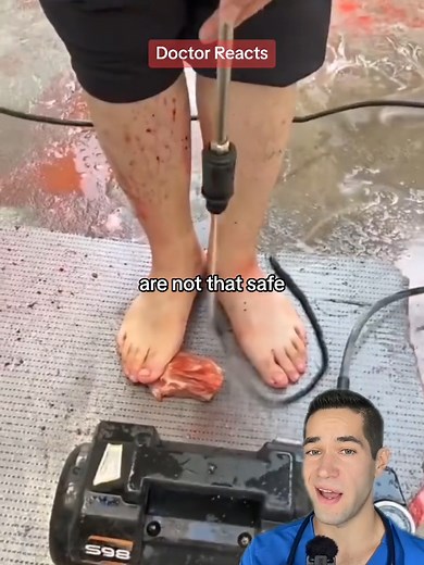 Inches from disaster 😳 #safety #powerwasher #safetytips #doctorreacts | power washing