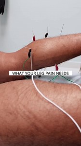 Treating Leg Pain! #legday #legs #legworkout #legpain #calf #calves #healthylegs #physiotherapy #physiotherapist #physio #physiolife #physicaltherapy #physicaltherapist #physicaltherapysession | Physical Therapy Session