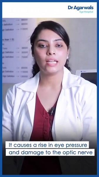 1K views · 23 reactions | The effects of Glaucoma slowly affect your sight, which can lead to vision loss. Here’s Dr Nidhi Jyoti Shetty, Consultant Ophthalmologist with some insights on how to tackle it! #Glaucoma #EyeCare #Healthcare #Eyes #Vision #DrAgarwalsEyeHospital #DrAgarwals | Dr. Agarwal's Eye Hospital | Facebook