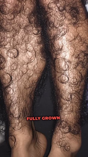 Empowering Hairy Women on Instagram: "https://patreon.com/c/EmpoweringHairyWomen ✨ Join us on Patreon today ✨ She’s flaunting her stunning, naturally hairy arms and legs – unapologetically her true self. Craving more empowering moments like this? Double-tap if you agree, save for daily inspo and tag a friend who needs to see real beauty. Comment #EmpoweringHairyWomen to join our movement celebrating unapologetic radiance! #feminine #hairy #hairygirl #hairywoman #armhair #hairyarms #leghair #hair
