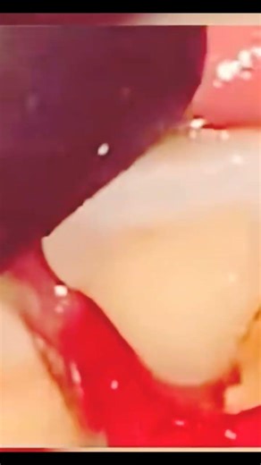 Want home Appointments for Teeth Scaling#shortsfeed #dentist #dentalartistry #elderly