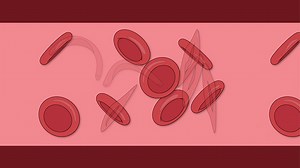 Characterisation of the Novel Allele, HLA-DQB1*06:531, Identified in a Saudi Individual - Watch Related Videos
