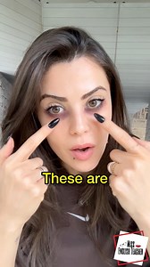 95K views · 1.6K reactions | Skin problems in #english: freckles,...