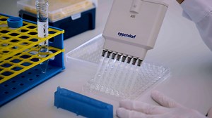 Vidéo: Un protocole simple de dosage par fosse pour visualiser et quantifier la résorption ostéoclastique in vitro