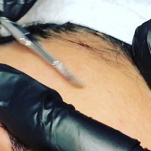 4.4K views · 26 reactions | What are the Benefits of Dermaplaning?...