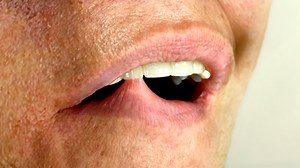 3.1K views · 37 reactions | Use This Retainer Removal Tip To AVOID Complete Embarrassment!  #embarassing #retainer #tips | TheBentistofficial | Facebook