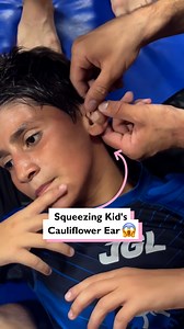 888K views · 2.2K reactions | Squeezing a cauliflower ear looks painful  | Four Nine | Facebook