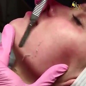 Dermaplane process: 1.Removes dead skin 2.Removes peach fuzz 3.Makeup goes on smoother 4.Products penetrate better. | Pawdose