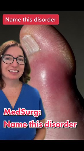 Level Up RN on TikTok