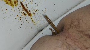 Gassy Diarrhea - video 2