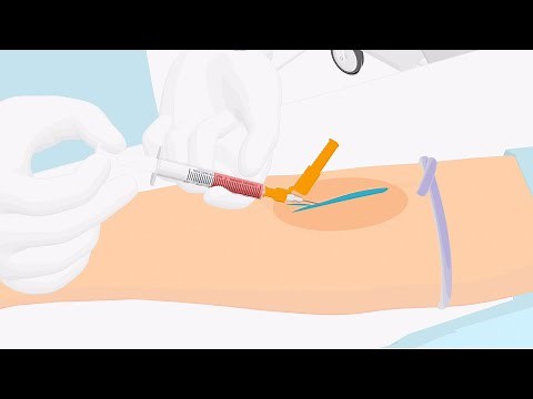 How to properly handle a venous blood gas sample