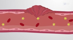 Vidéo: Coagulation