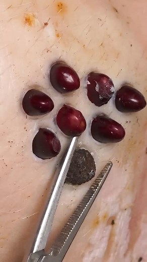 They Lifted the Nail Bed — And What They Found Was Terrifying Q992 #toenails #pedicure #OddlySatisfying #fblifestyle #fypシ Beautiful moments of care and relaxation through a gentle pedicure experience. Simple, clean, and satisfying. ￼ ￼ Disclaimer: This video is for educational and relaxation purposes only. All content belongs to the respective owners, no copyright infringement is intended. | Help remove ticks