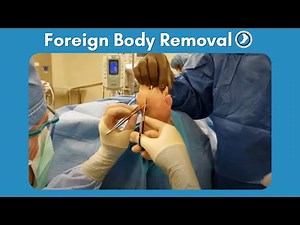 Foreign Body Removal Surgery