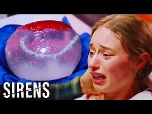 Baby Born STILL Inside The Embryonic Sac | Chicago Med | Sirens