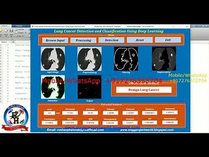 Lung Cancer Detection Using Deep Learning CNN Matlab Project With Source Code Lung Cancer Analysis