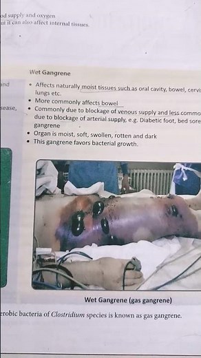 Types of Gangrene Explained | Dry, Wet, Gas & More | Nursing & Medical Lecture