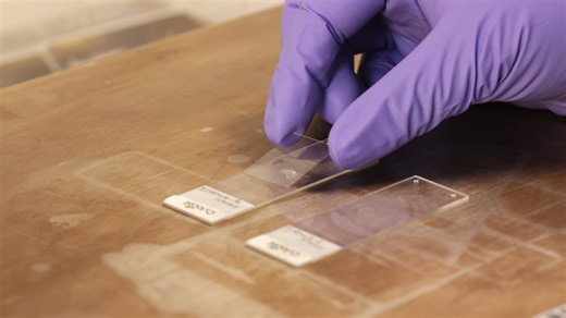 Fluorescence in situ hybridization (FISH) protocol tips - Probe application: 'Try not to push down too hard on the coverslip...'