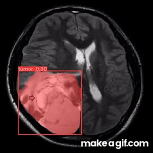 Brain Tumor Detection YoloV8|Computer Vision| Medical Imaging|Healthcare|Project|Yolo|Roboflow on Make a GIF