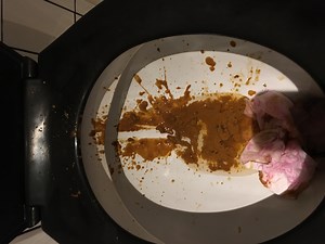 splatter diarrhea at home 10082018