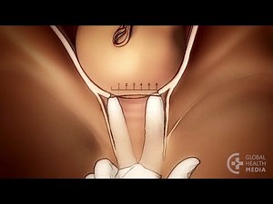 The Vaginal Exam in Labor - Childbirth Series